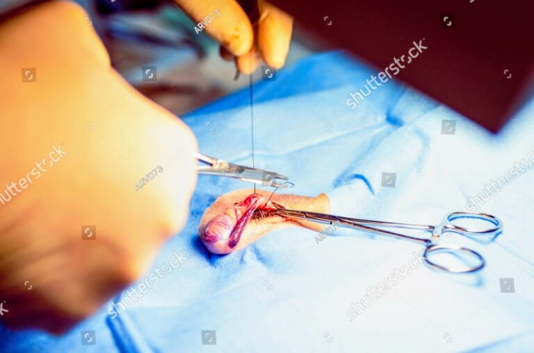 stock photo vet castrating a dog cutting the spermatical cord with a scissors operation by a veterinarian 2261604135~2